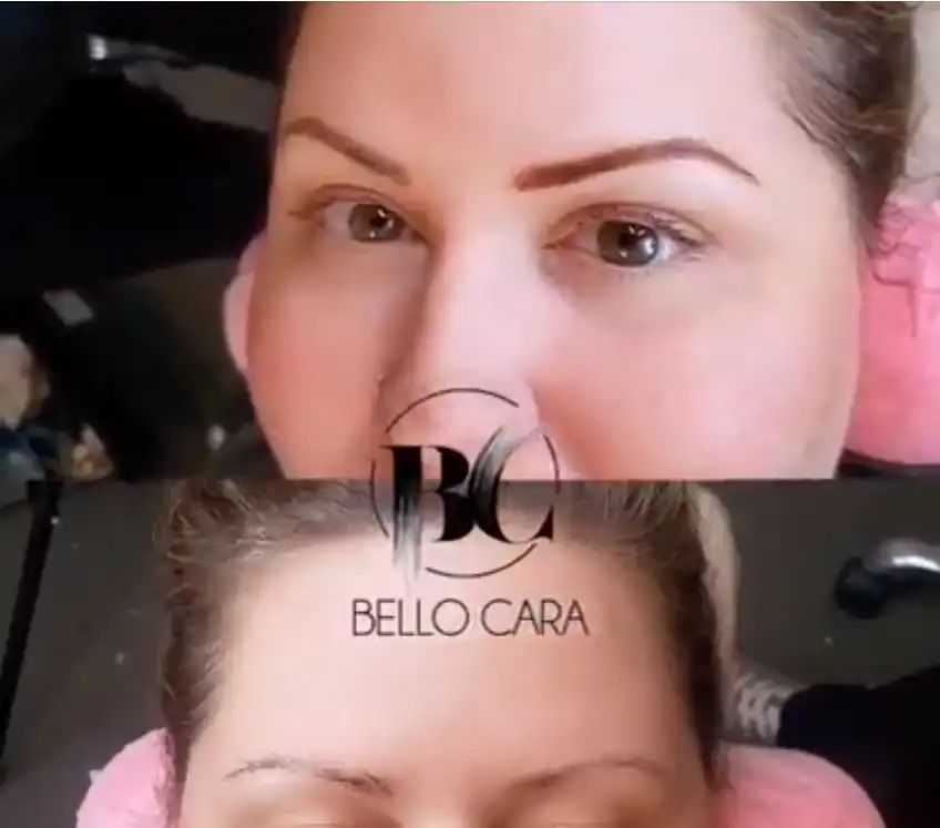 microblading,brows,tattoo removal